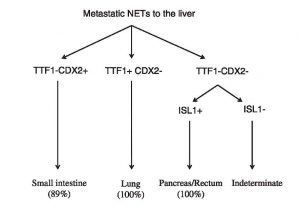 Figura 3. Esquema utilizado para tratar de determinar el origen en metástasis hepáticas de tumores neuroendocrinos