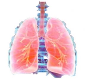 Figura 2. Esquema-dibujo de tumor neuroendocrino pulmonar.